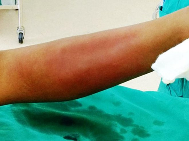 Be trai suyt mat chan vi chua 'thay lang vuon' hinh anh 1