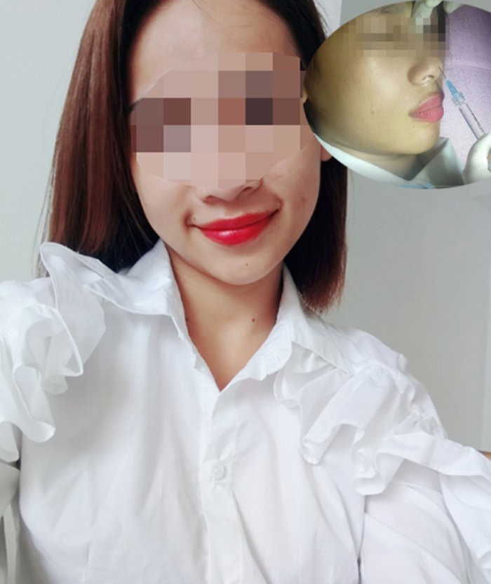 nang-mui-hong1-1124-1513407956