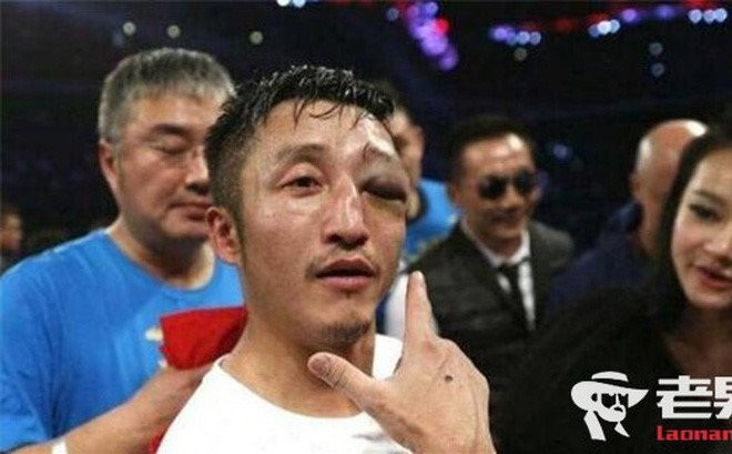 Sao vo thuat Trung Quoc mu dot ngot, cong ty quan ly: 'Tu lam tu chiu' hinh anh 2