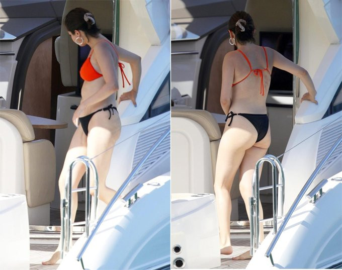 Sẹo ở đùi là từ vết mổ cấp cứu ngay sau ca phẫu thuật ghép thận của Selena vào tháng 5/2017. Nữ ca sĩ gặp biến chứng khi một động mạch bị vỡ và bác sĩ phải khẩn cấp lấy một tĩnh mạch từ chân của cô để tạo ra một động mạch mới giúp ổn định quả thận vừa được ghép.