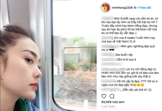 Bat chap nghi an phau thuat tham my, Minh Hang tiep tuc khoe cam nhon hinh anh 1