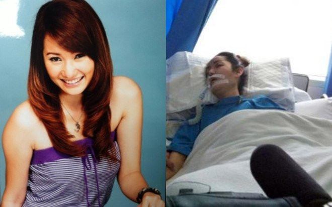 Nhung nghe si tre chau A tu vong sau phau thuat tham my hinh anh 2