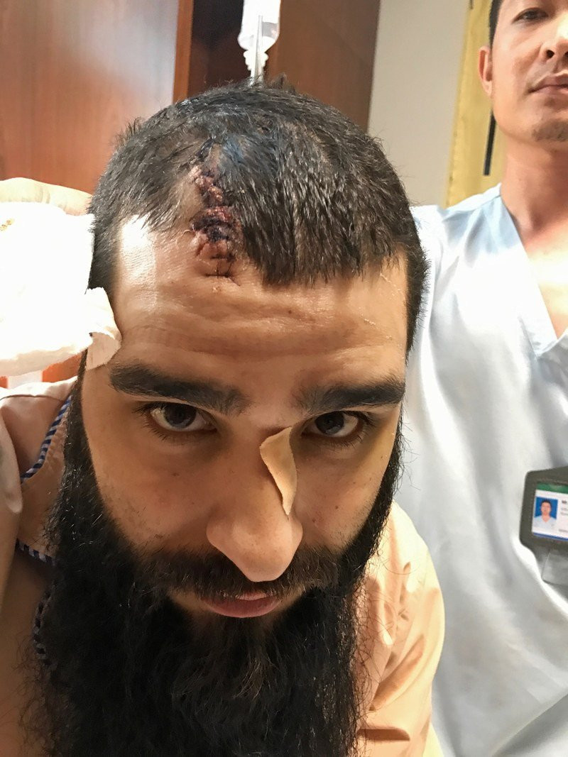 Dao dien 'Kong': 'Toi suyt bi giet chet o VN va se tim ra hung thu' hinh anh 2