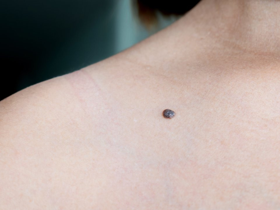 10 dau hieu co the canh bao ung thu som hinh anh 2