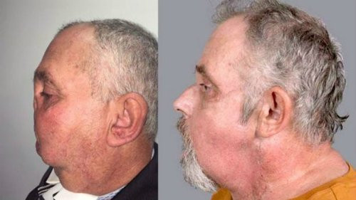 1536852172380-2719-1536916762