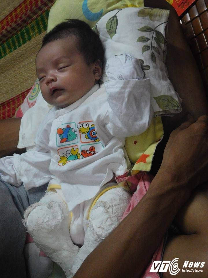 17555574_1262873000498416