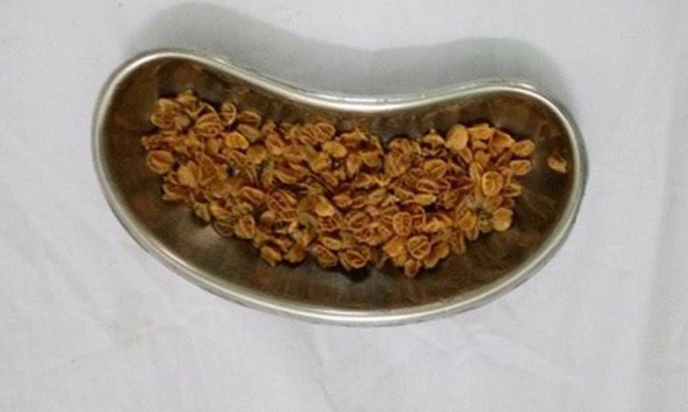 70g-so-ri-trong-benh-nhi-11-tuoi-hinh-2-1505269926997