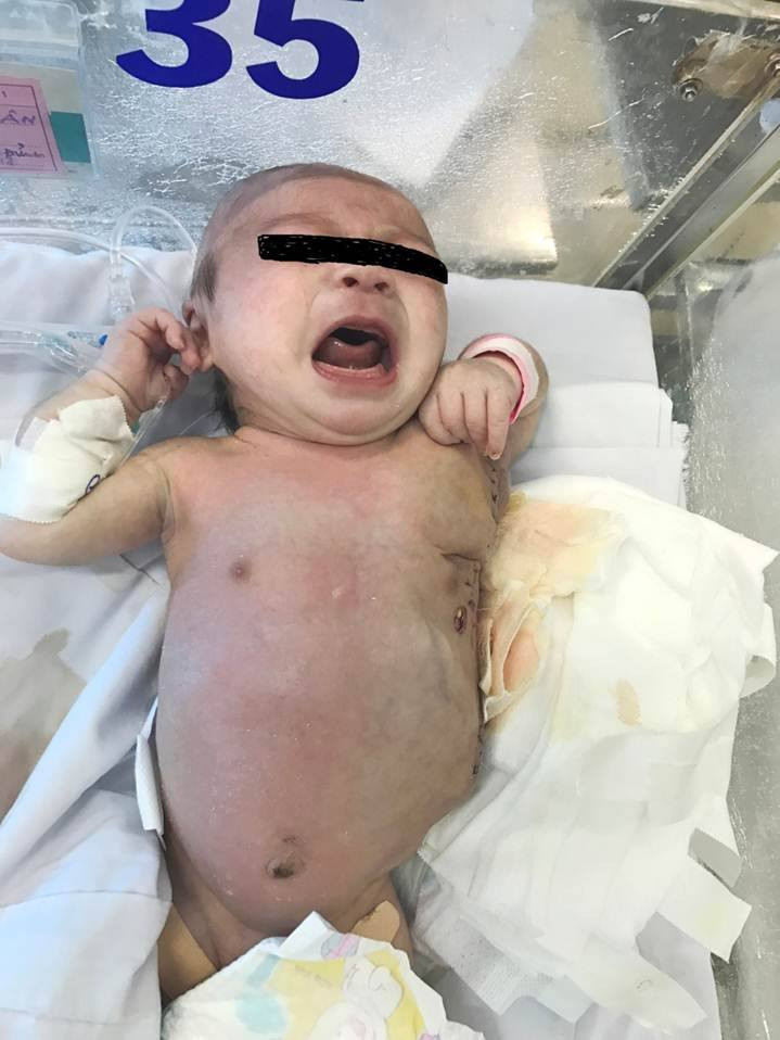 23022425_1444547072307240_1995140897_n