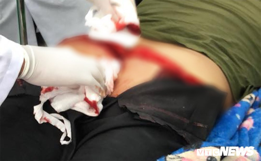 26804898_854906208011500_1564461419181777653_n