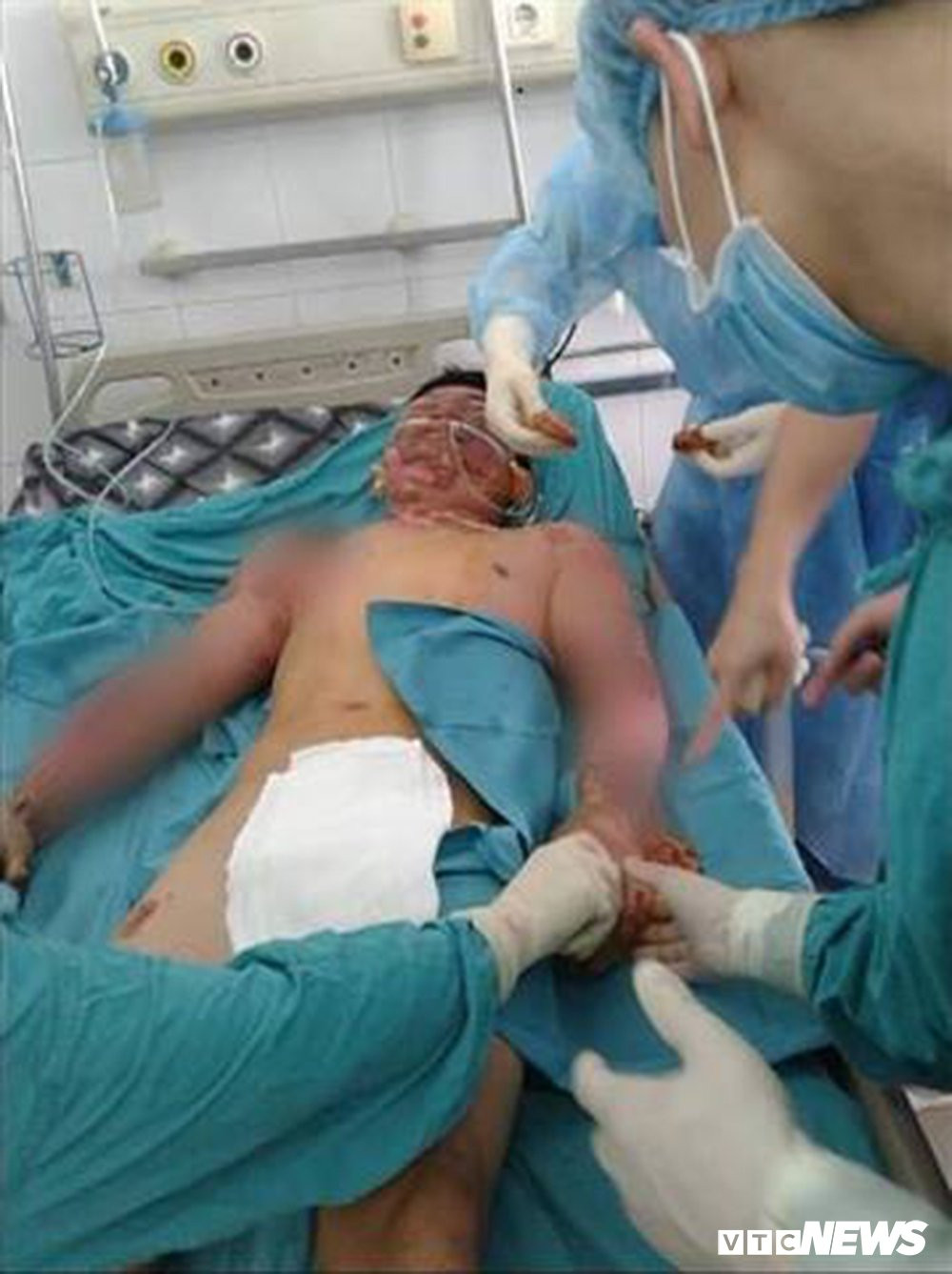 30831571_1027520304072468_1007378423_n 8