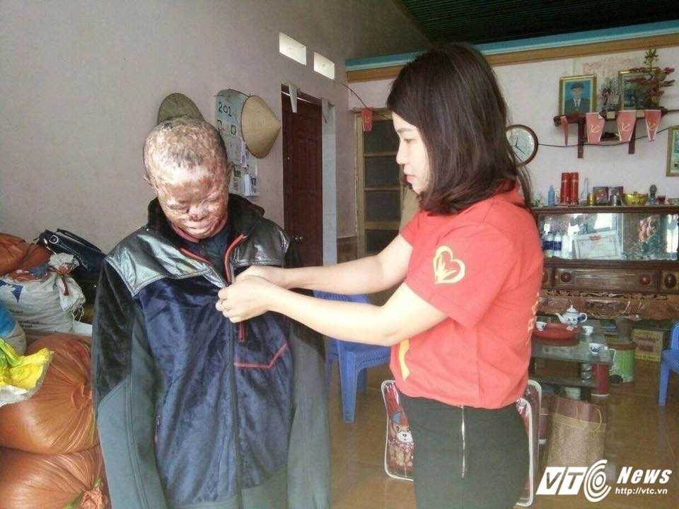 cau be bi benh mat quy