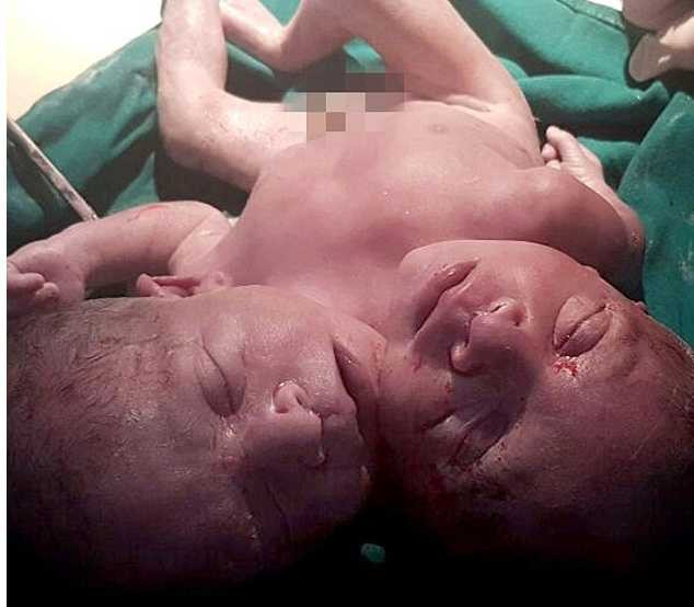 3D55762400000578-0-image-a-50_1487353037779