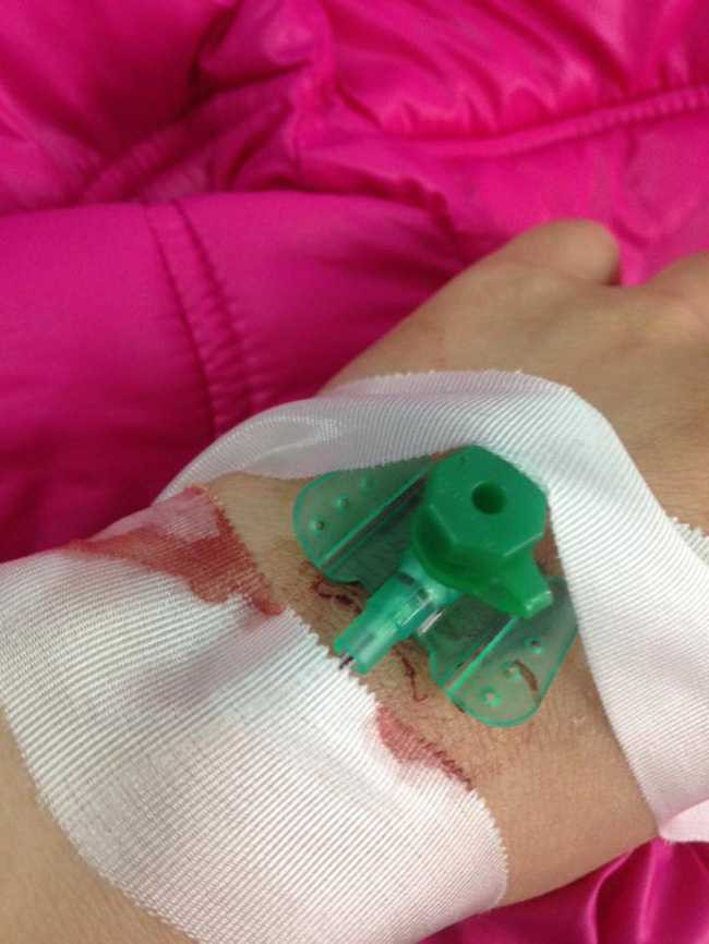 ung-thu-9-20-1-1487507286526