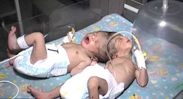 3DCD5D0C00000578-4269590-image-a-13_1488326701310