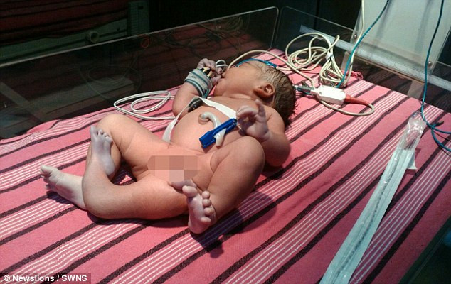 be so sinh co 3 chan