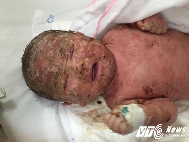 17554347_769605159854904_