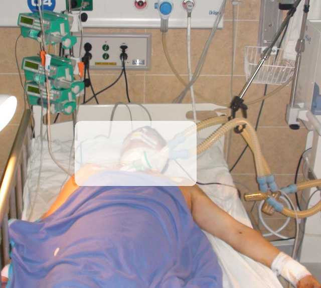 Cứu sống người đàn ông tự cứa cổ - Ảnh 1