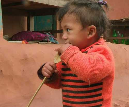 Hiếm gặp: Bé trai 2 tuổi mọc thêm tay ở... lưng - 1