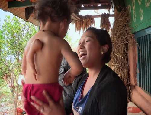 Hiếm gặp: Bé trai 2 tuổi mọc thêm tay ở... lưng - 3