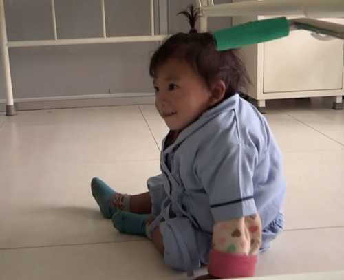 Hiếm gặp: Bé trai 2 tuổi mọc thêm tay ở... lưng - 4