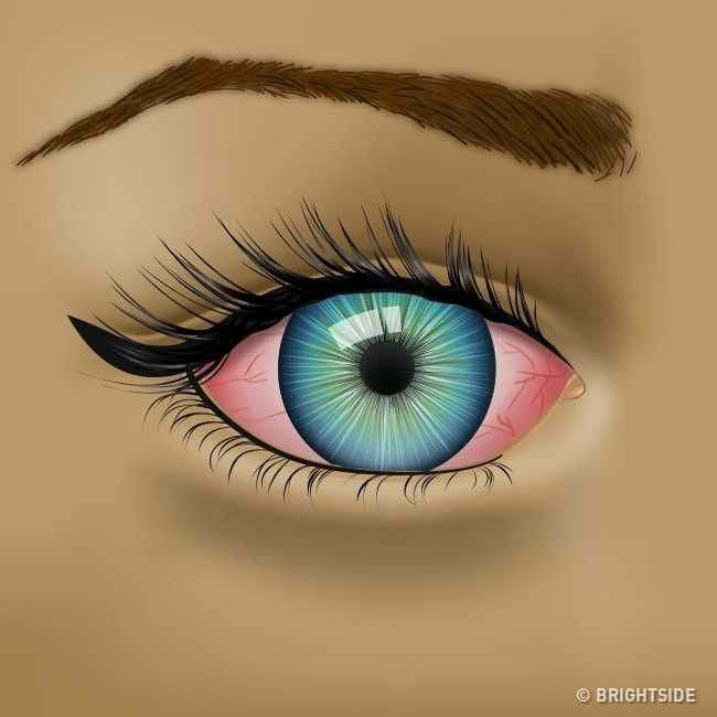 9 dau hieu bat thuong o mat canh bao suc khoe co van de hinh anh 3