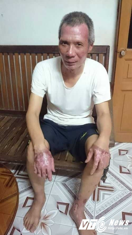 nguoi-dan-ong-lieu-chet-om-qua-bom-gas-dang-chay-cuu-vo-va-hang-chuc-hoc-sinh-0