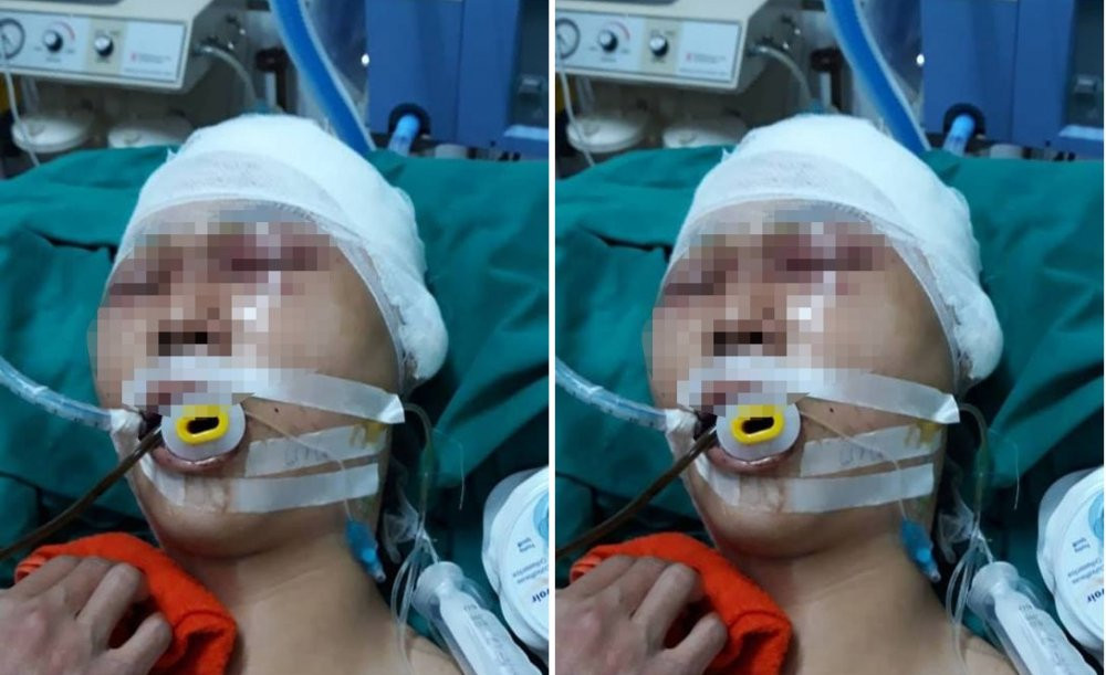 nam_sinh_bi_danh_tran_thuong_so_nao