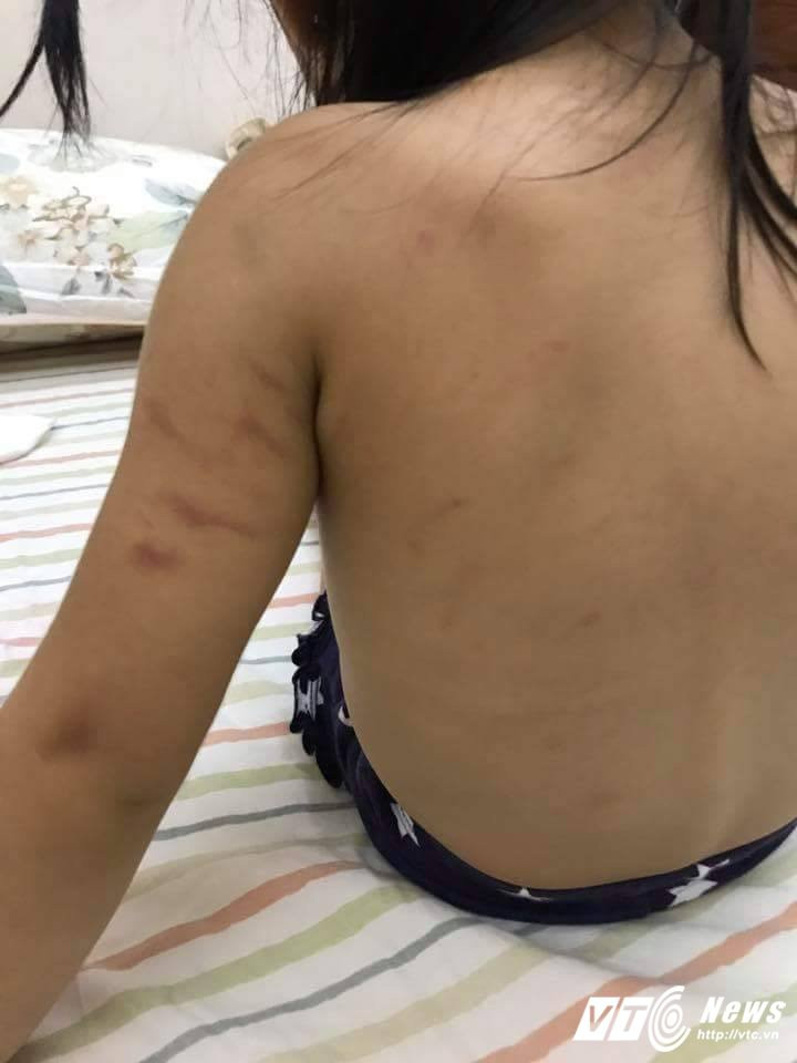 19022081_776200905872534_1941991015_n 3