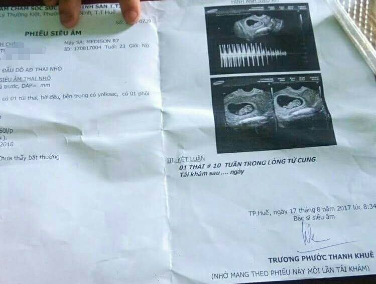 21015394_1463733190383397_1838209277_n 4