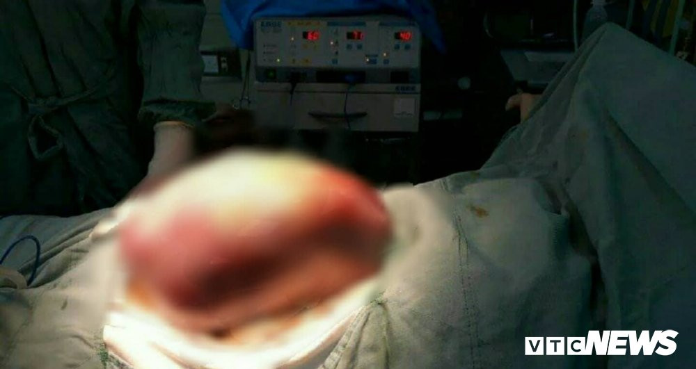 29694025_1709380862485294_413141816_o