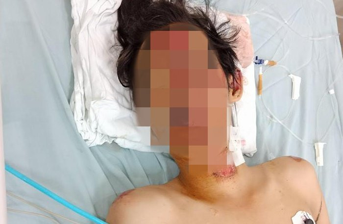 csgt-bi-to-dap-xe-va-danh-nguoi-di-xe-may-dan-den-tai-nan-1125053-3-1413473