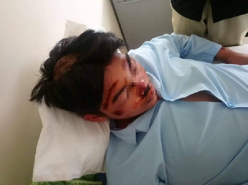 hoc-sinh-bi-danh-o-hue111