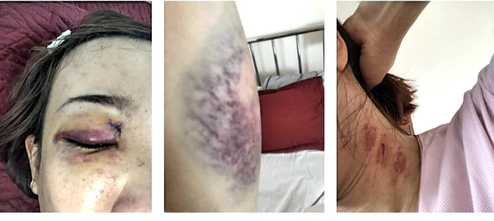 danh-phu-nu-mang-thai-quang-tri-nguoiduatin2