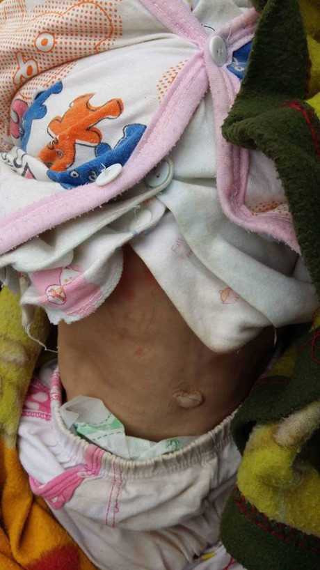 Hinh anh moi cua be gai Lao Cai 14 thang tuoi nang 3,5kg sau hon 3 thang duoc me nuoi cham soc - Anh 11