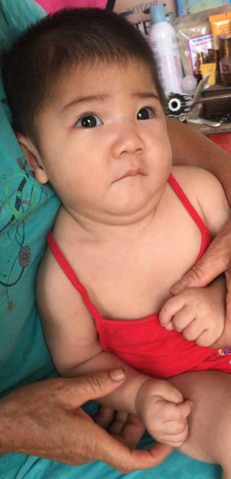 Hinh anh moi cua be gai Lao Cai 14 thang tuoi nang 3,5kg sau hon 3 thang duoc me nuoi cham soc - Anh 2