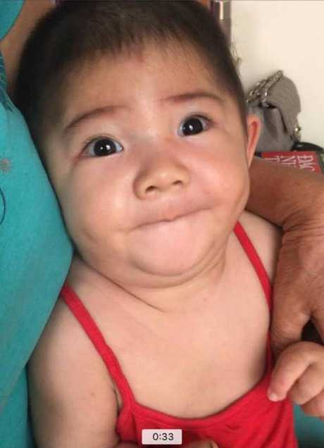 Hinh anh moi cua be gai Lao Cai 14 thang tuoi nang 3,5kg sau hon 3 thang duoc me nuoi cham soc - Anh 3