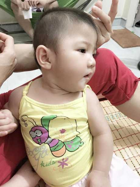 Hinh anh moi cua be gai Lao Cai 14 thang tuoi nang 3,5kg sau hon 3 thang duoc me nuoi cham soc - Anh 4