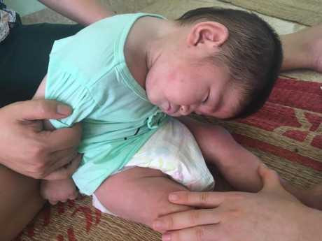 Hinh anh moi cua be gai Lao Cai 14 thang tuoi nang 3,5kg sau hon 3 thang duoc me nuoi cham soc - Anh 7