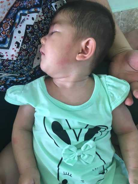 Hinh anh moi cua be gai Lao Cai 14 thang tuoi nang 3,5kg sau hon 3 thang duoc me nuoi cham soc - Anh 8