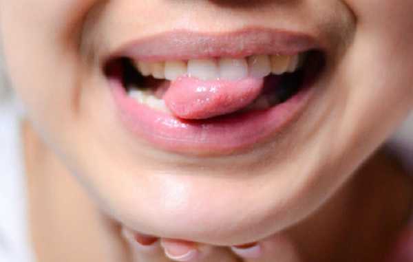 Ung thư lưỡi dễ bị bỏ qua vì nhầm với nhiệt miệng. Ảnh minh họa