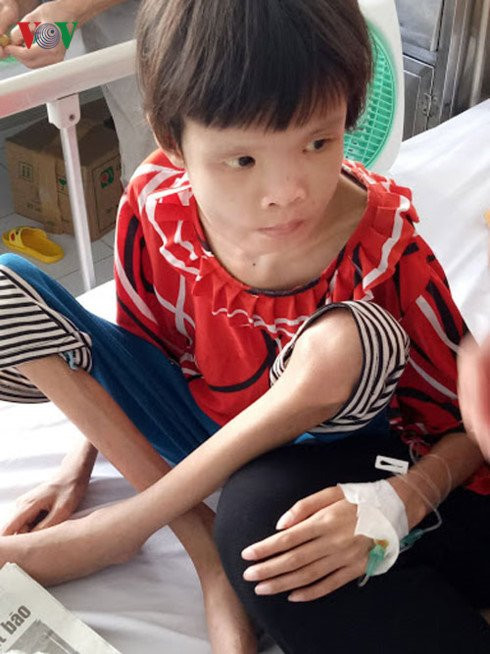 vov_suy_dinh_duong_5_kqpg