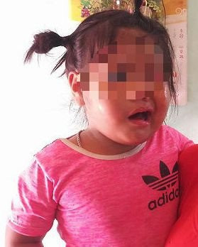 chau-y-bi-danh-liet-day-than-kinh