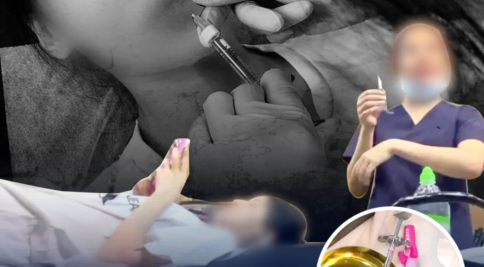 Bóc trần sự thật đằng sau những 'chứng chỉ hành nghề' tiêm filler, botox