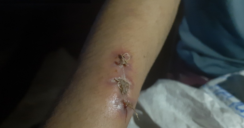 Người cứu cậu bé bị chủ tra tấn kể lại thời khắc nạn nhân đứng co ro cạnh chùa