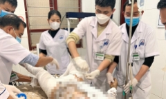Người đàn ông tẩm xăng tự thiêu, nghi do mâu thuẫn với vợ