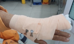 Đi nhắc nợ, nhân viên điện lực ở TP.HCM bị khách hàng đánh nhập viện