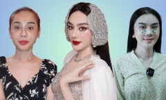 Tâm sự của người đàn ông nghiện phẫu thuật thẩm mỹ 