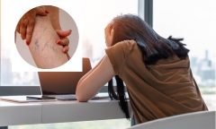 Ngồi 8 tiếng mỗi ngày: Nguyên nhân gây ra căn bệnh dễ tử vong ngay ít ai biết