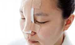 Những trường hợp không nên nâng mũi