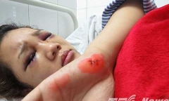 Nghi vấn thiếu úy công an đánh bạn gái nhập viện: 'Nó bảo em khai là do say rượu nên hai đứa đánh nhau'